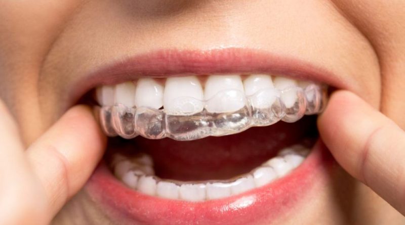 Ortodontia e seu tratamento corretivo