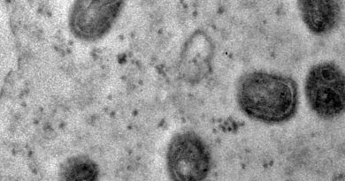 Fiocruz registra imagens de replicação do vírus monkeypox em célula