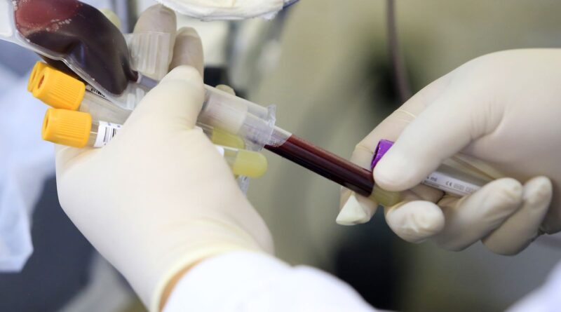 Inca registra queda de 30% no número de doadores de sangue em setembro