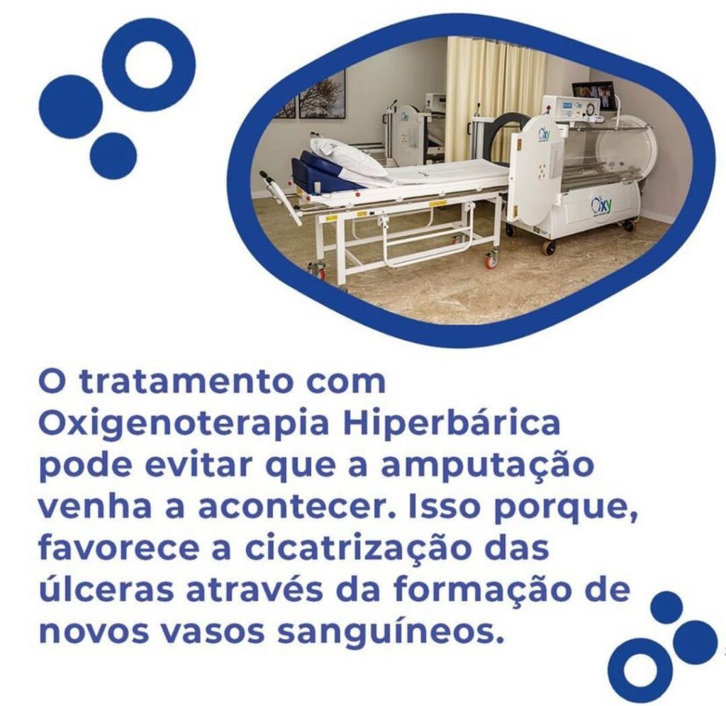 Bodyclinics Estética Avançada adota uso de Câmaras Hiperbáricas para melhorar resultados