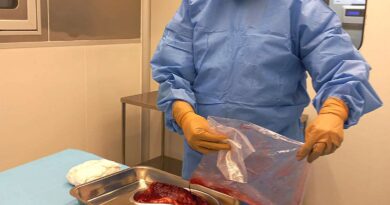 Pesquisa desenvolve curativos biológicos à base de placenta