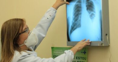 Conselho aprova novas diretrizes para tratamento da tuberculose no SUS