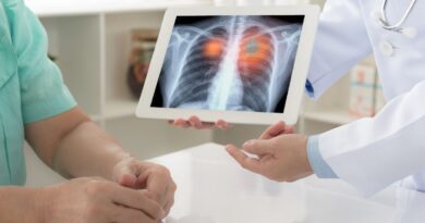 Estudos mostram eficácia de novos tratamentos para pacientes com tipo mais comum de câncer de pulmão