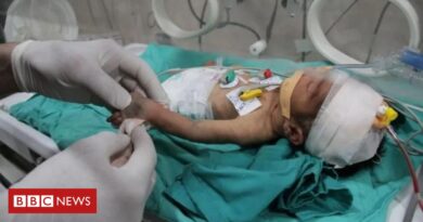 Conflito Israel-Hamas: recém-nascidos começam a morrer de fome em Gaza