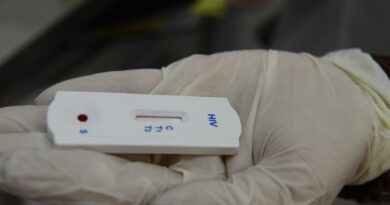 Saúde orienta farmácias sobre testes para HIV, sífilis e hepatites