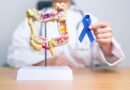 Modelo anatômico do intestino ao lado de laço azul em mãos de médico, simbolizando a prevenção ao câncer colorretal
