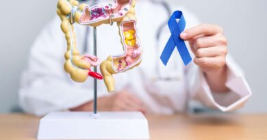Modelo anatômico do intestino ao lado de laço azul em mãos de médico, simbolizando a prevenção ao câncer colorretal
